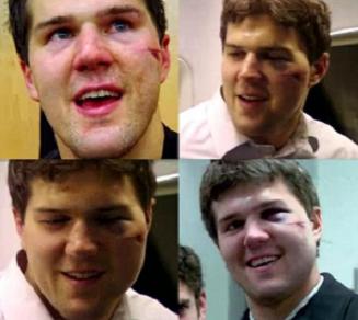 bennysface