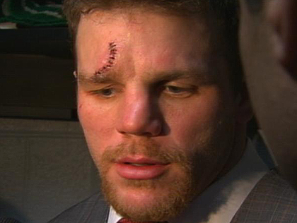 thornton-stitches