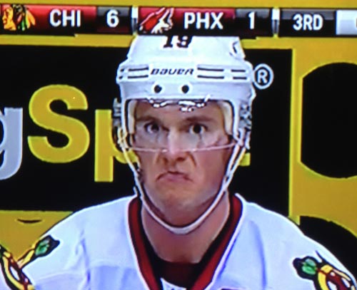 toewsface